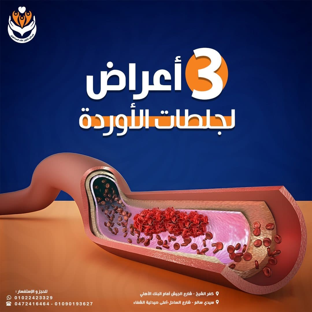 إنفوجرافيك التوعية بأعراض جلطات الأوردة