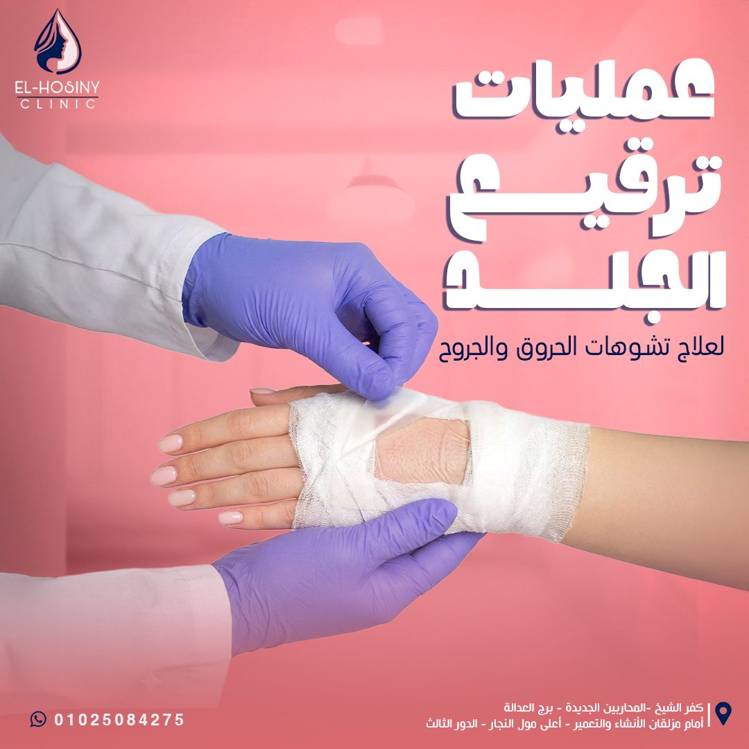 Skin Grafting